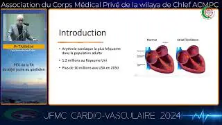 Pr TAHMI MOHAMED : Fibrillation atriale du sujet jeune