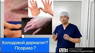 Суукта кол, бетке майда будур чыгып кычышса, анда…..