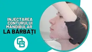 Injectarea conturului mandibular la barbati | DermaBeauty Clinique