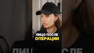 Как выглядит Боня после операции?