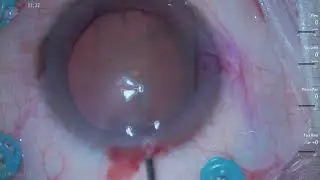 Horizontal Chop