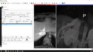 SlicerRVXLiverSegmentation - Export scene