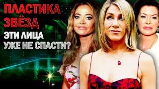 КАК НА САМОМ ДЕЛЕ ВЫГЛЯДИТ ВЕЧНАЯ МОЛОДОСТЬ ЗВЁЗД | ЖЕРТВЫ ПЛАСТИКИ