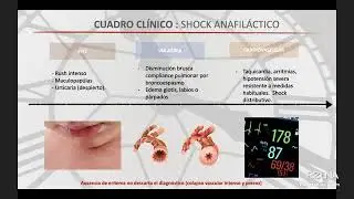 Conversatorio  Shock Anafiláctico en Odontología