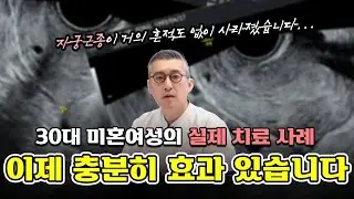하이푸 시술 이제는 충분히 효과 있습니다
