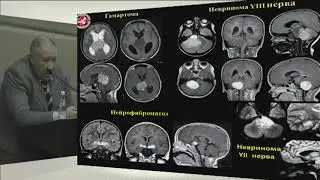 Стандарты, показания и методика исследования ГМ