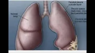 Proven Asbestos Lawyers