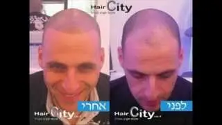 קעקוע שיער במרכז קעקוע שיער קצוץ לגברים עם קרחת