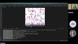 Using Chapel's 'Image' module to visualize computations