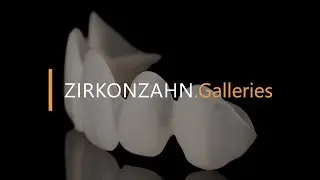 Mock-up in Multistratum® Flexible – Plaster-free articulation using 3D models | Zirkonzahn.Galleries