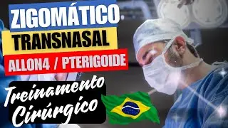 Implante Zigomático - Por Que o Brasil Está Virando Referência?