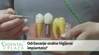 Održavanje oralne higijene implantata?