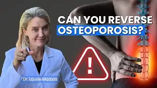 Reversing Osteoporosis: Can Lifestyle Changes Make a Difference?