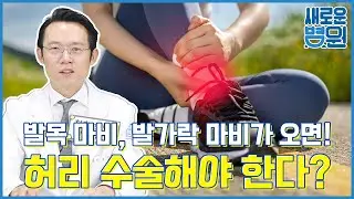 발목 마비, 발가락 마비가 오면 허리 수술해야 한다?
