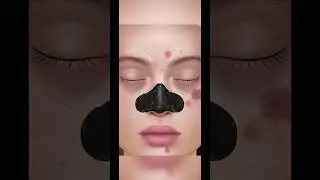 Asmr blackhead remove on nose 