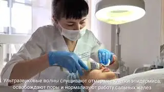 Чистка лица
