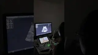 CAS and 4D Ultrasound at Doc Aid Diagnostic Center Q.C #congenitalanomalyscan #4Dultrasound