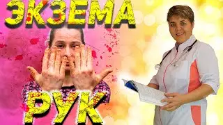 Eczema on the hands, causes, diagnosis, treatment, prevention.