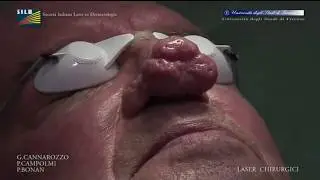 Rinofima CO2