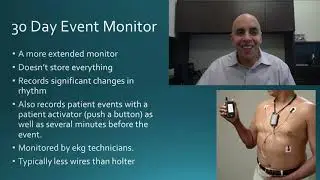 Heart Rhythm Monitoring