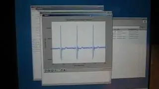 DIY PC ECG using a Sound Card