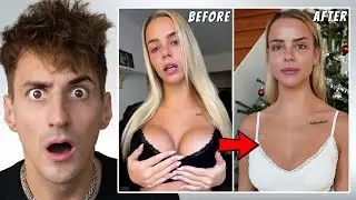Why My Girlfriend Had to Get Her Breast Implants Removed (-$20,000)