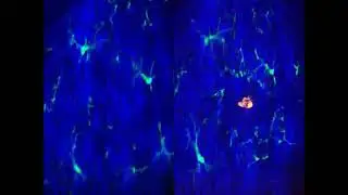 In vivo imaging of microglial cells