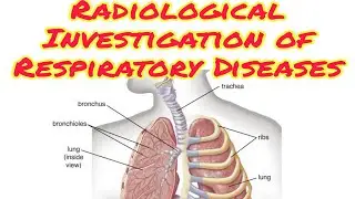 Radiological Investigation of Respiratory Diseases Part 1