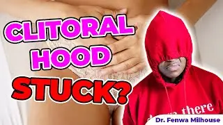 CLITORAL PHIMOSIS | CLITORAL HOOD STUCK | Dr. Milhouse