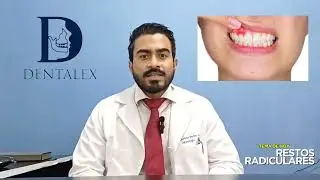 #SaludBucal RESTOS RADICULARES QUE ES Y COMO AFECTAN?