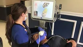 iTero Scan for Invisalign