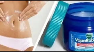 विक्स वेपोरब के चमत्कारी प्रयोग | Surprising Benefits And Uses Of Vicks Vaporub