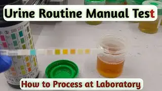 urine routine test | Urine Routine Manual Test