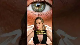 Что портит состояние кожи глаз под глазами?#дерматолог #морщинывокругглаз #морщины #трихолог #волосы