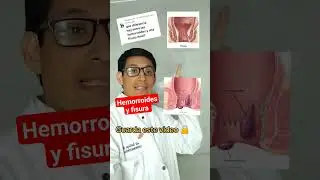 Hemorrhoids and fissures 