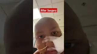 After surgery #cancer sucks #gametimewithjaime