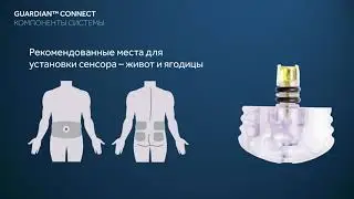 Система Guardian™ Connect, часть 1.