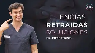 Tratamientos para ENCÍAS RETRAÍDAS: ¿Hay solución? ¿Las encías se regeneran? ¿Cuál es su CAUSA?