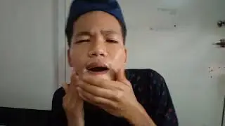 Kojic Commercial