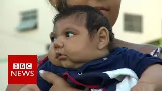 Zika 'more dangerous than thought' - BBC News