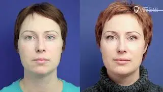 Ментопластика от Гурьянова А.С.