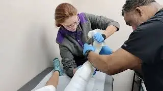 Long leg cast video 
