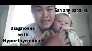 Asan ang papa ng anak ku?May Hyperthyroidism  aku/filipina  Ukrainian