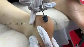 Педикюр колпачками с брендом PinkRoyss 