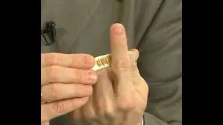 Су Джок терапия - устраняет боль в суставе.