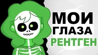 У МЕНЯ ГЛАЗА РЕНТГЕН (АНИМАЦИЯ | ИСТОРИЯ ИЗ ЖИЗНИ)