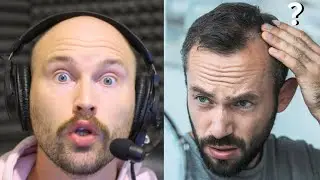 The Hair Loss Industry Is TERRIFIED YOU'LL Know THIS!