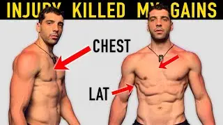 I LOST MY GAINS: Surgery or Natural Recovery?