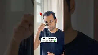 Remove BLACKHEADS properly ✅