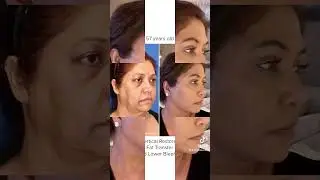 57 Year Old Woman LOOKS 20 YEARS YOUNGER!